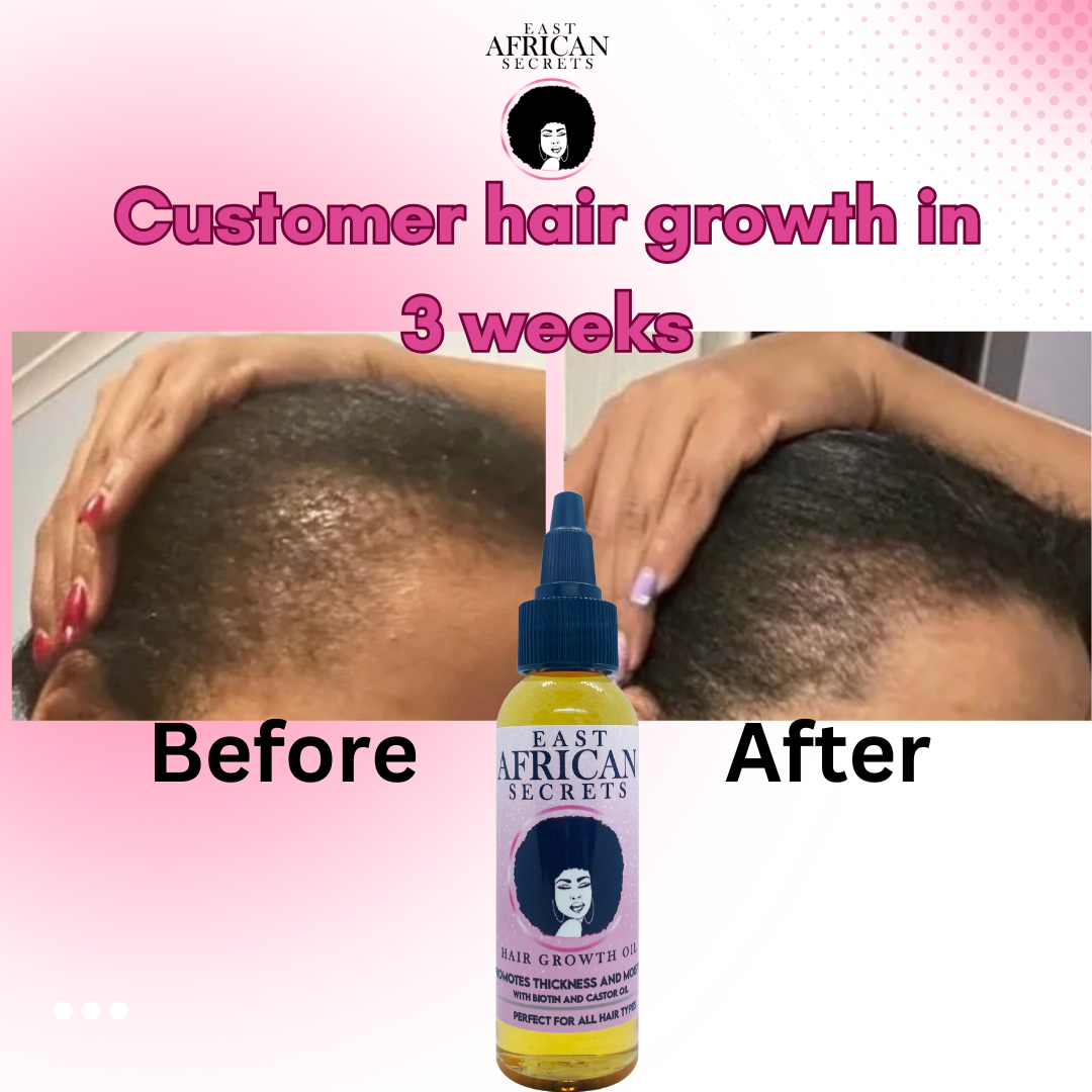 Rapid Hair Growth Oil