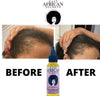 Rapid Hair Growth Oil