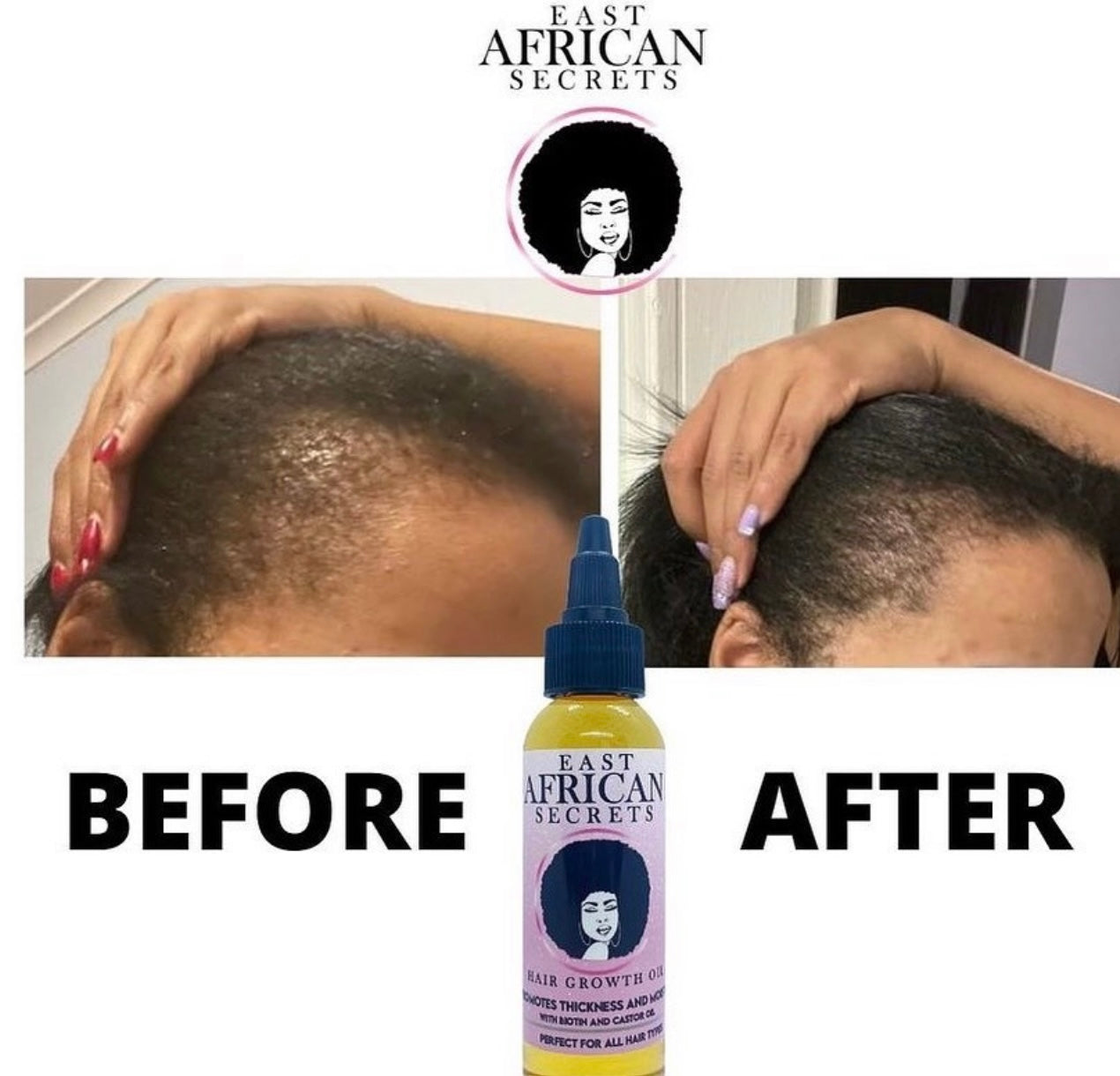 Hair Growth Bundle